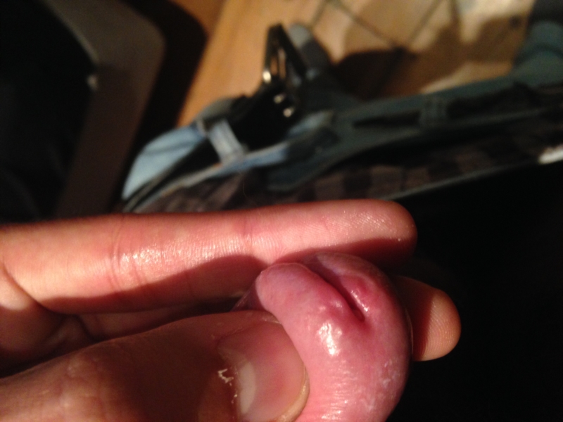 Swollen Penis Hole 28