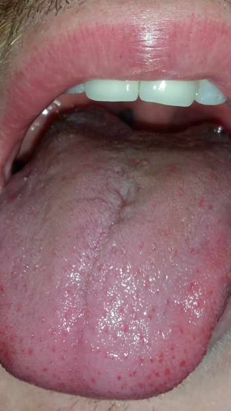 Oral Thrust 16